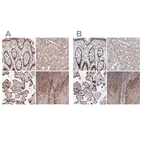 Anti-PDS5A Antibody