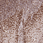 Immunohistochemical staining of human tonsil shows strong nuclear positivity in squamous epithelial cells.