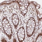 Immunohistochemical staining of human rectum shows strong nuclear positivity in glandular cells.