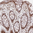 Immunohistochemical staining of human rectum shows strong nuclear positivity in glandular cells.