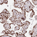 Immunohistochemical staining of human placenta shows strong nuclear positivity in trophoblastic cells.