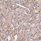 Immunohistochemical staining of human kidney shows strong nuclear positivity in cells in tubules.