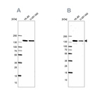 Western blot analysis using Anti-PDS5A antibody HPA036662 (A) shows similar pattern to independent antibody HPA036661 (B).