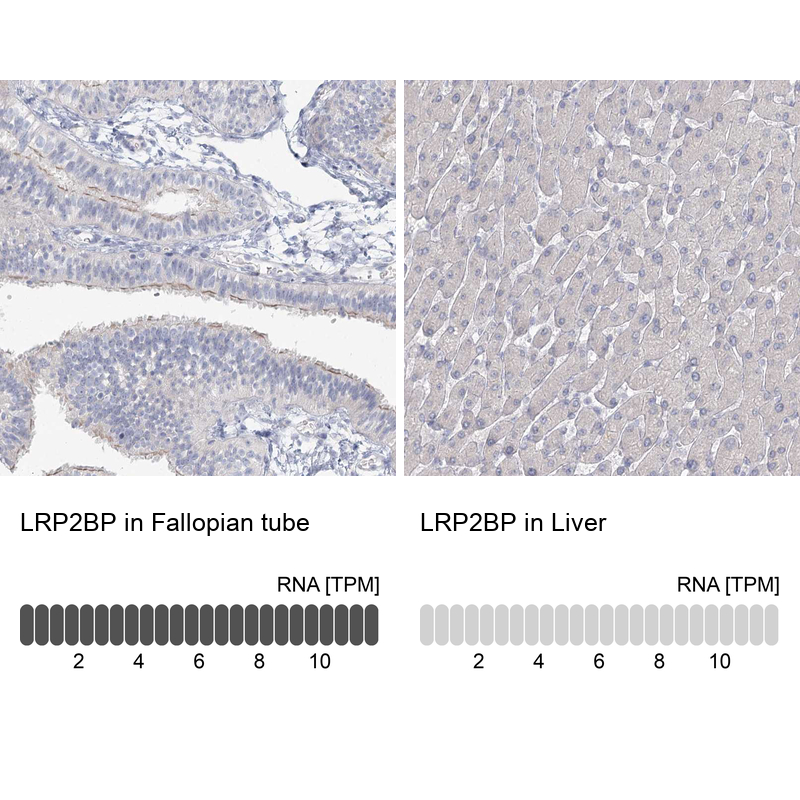 Anti-LRP2BP Antibody