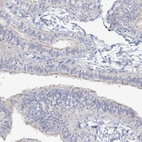 Immunohistochemical staining of human fallopian tube shows moderate positivity in cilia in glandular cells.