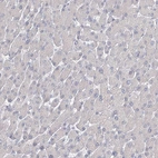 Immunohistochemical staining of human liver shows no positivity in hepatocytes as expected.