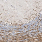 Immunohistochemical staining of human cerebellum shows weak cytoplasmic positivity in Purkinje cells as well as positivity in neural fibers.