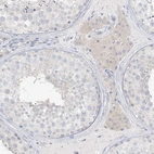 Immunohistochemical staining of human testis shows weak cytoplasmic positivity in Leydig cells.