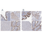 Immunohistochemical staining of human colon, kidney, liver and small intestine using Anti-SLC9A3 antibody HPA036669 (A) shows similar protein distribution across tissues to independent antibody HPA036493 (B).