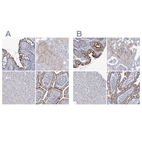 Immunohistochemical staining of human colon, kidney, liver and small intestine using Anti-SLC9A3 antibody HPA036669 (A) shows similar protein distribution across tissues to independent antibody HPA036493 (B).