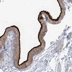 Immunohistochemical staining of human gallbladder shows strong positivity in apical membrane in glandular cells.