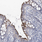 Immunohistochemical staining of human colon shows strong positivity in apical membrane in glandular cells.