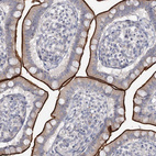Immunohistochemical staining of human small intestine shows strong positivity in apical membrane in glandular cells.