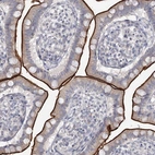 Immunohistochemical staining of human small intestine shows strong positivity in apical membrane in glandular cells.
