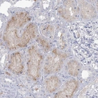 Immunohistochemical staining of human kidney shows weak positivity in apical membrane in cells in tubules.
