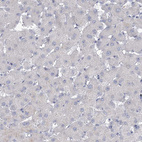 Anti-SLC9A3 Antibody