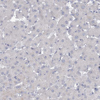 Immunohistochemical staining of human liver shows no membranous positivity in hepatocytes as expected.