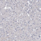 Immunohistochemical staining of human liver shows no membranous positivity in hepatocytes as expected.