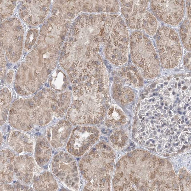 Anti-TRMT10C Antibody