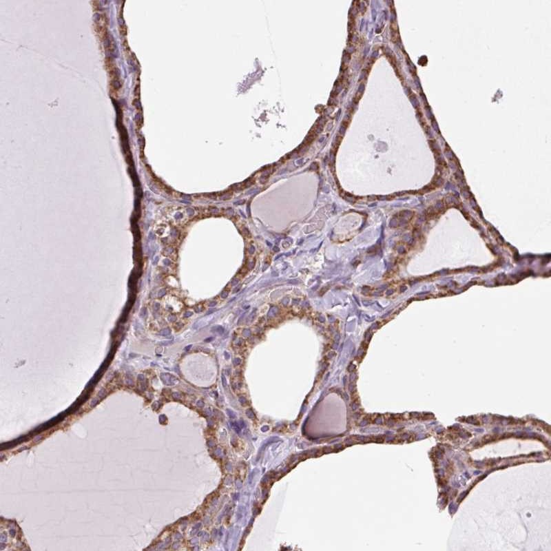 Anti-PLCG1 Antibody