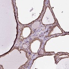 Anti-PLCG1 Antibody
