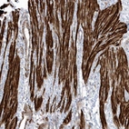Anti-GTDC1 Antibody