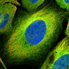 Immunofluorescent staining of human cell line U-2 OS shows localization to plasma membrane & cytosol.