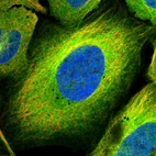 Immunofluorescent staining of human cell line U-2 OS shows localization to plasma membrane & cytosol.