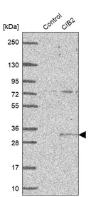 Western blot analysis in control (vector only transfected HEK293T lysate) and CIB2 over-expression lysate (Co-expressed with a C-terminal myc-DDK tag (~3.1 kDa) in mammalian HEK293T cells, LY416682).