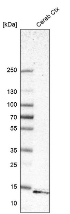 Western blot analysis in human cerebral cortex tissue.
