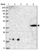 Lane 1: Marker [kDa] 230, 130, 95, 72, 56, 36, 28, 17, 11_br/_Lane 2: Human cell line RT-4_br/_Lane 3: Human cell line U-251MG sp_br/_Lane 4: Human plasma (IgG/HSA depleted)_br/_Lane 5: Human liver tissue