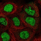 Anti-TOPBP1 Antibody