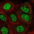Anti-TOPBP1 Antibody