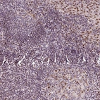 Immunohistochemical staining of human tonsil shows strong positivity in nucleoli in non-germinal center cells, squamous epithelial cells and germinal center cells with addition cytoplasmic-nuclear positivity.