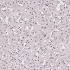 Immunohistochemical staining of human liver shows strong positivity in nucleoli in hepatocytes.