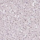 Immunohistochemical staining of human liver shows strong positivity in nucleoli in hepatocytes.