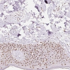 Immunohistochemical staining of human skin shows strong positivity in nucleoli in squamous epithelial cells with additional cytoplasmic-nuclear positivity.