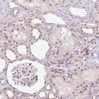 Immunohistochemical staining of human kidney shows strong positivity in nucleoli in cells in tubules and cells in glomeruli.