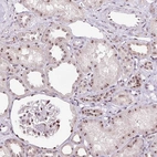 Immunohistochemical staining of human kidney shows strong positivity in nucleoli in cells in tubules and cells in glomeruli.