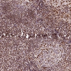Immunohistochemical staining of human tonsil shows strong positivity in nucleoli in non-germinal center cells, squamous epithelial cells and germinal center cells with addition cytoplasmic-nuclear positivity.