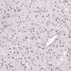 Anti-GNL3 Antibody