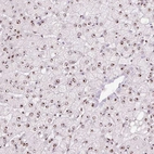 Immunohistochemical staining of human liver shows strong positivity in nucleoli in hepatocytes.