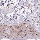 Immunohistochemical staining of human skin shows strong positivity in nucleoli in squamous epithelial cells with additional cytoplasmic-nuclear positivity.