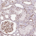 Immunohistochemical staining of human kidney shows strong positivity in nucleoli in cells in tubules and cells in glomeruli.