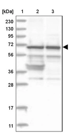 Lane 1: Marker [kDa] 230, 130, 95, 72, 56, 36, 28, 17, 11_br/_Lane 2: Human cell line RT-4_br/_Lane 3: Human cell line U-251 MG