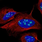 Immunofluorescent staining of human cell line U-2 OS shows localization to nucleoli & nuclear bodies.