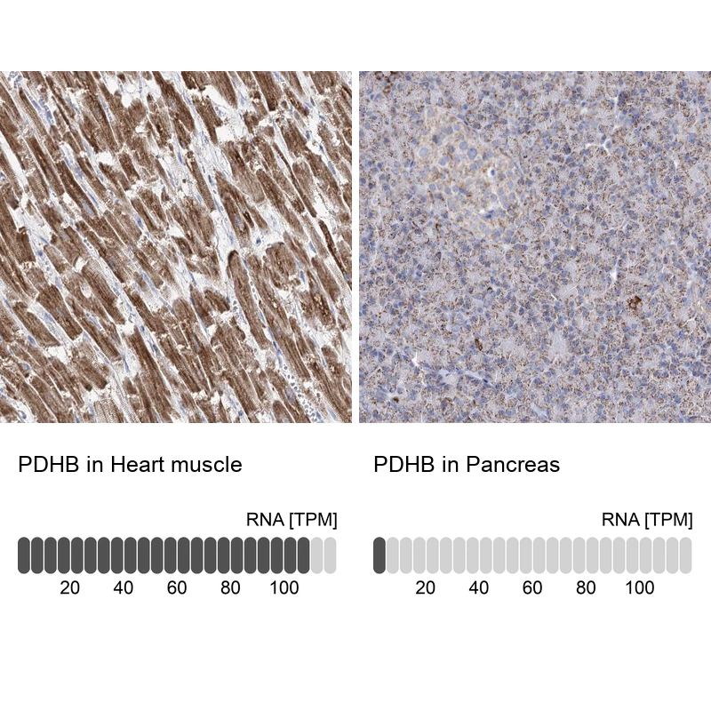 Rabbit Polyclonal Anti-PDHB Antibody - Buy for research - Highly ...