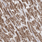 Immunohistochemical staining of human heart muscle shows strong cytoplasmic positivity in cardiomyocytes.