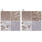 Immunohistochemical staining of human cerebral cortex, heart muscle, kidney and pancreas using Anti-PDHB antibody HPA036745 (A) shows similar protein distribution across tissues to independent antibody HPA036744 (B).