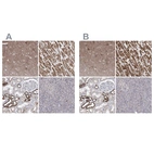 Immunohistochemical staining of human cerebral cortex, heart muscle, kidney and pancreas using Anti-PDHB antibody HPA036745 (A) shows similar protein distribution across tissues to independent antibody HPA036744 (B).